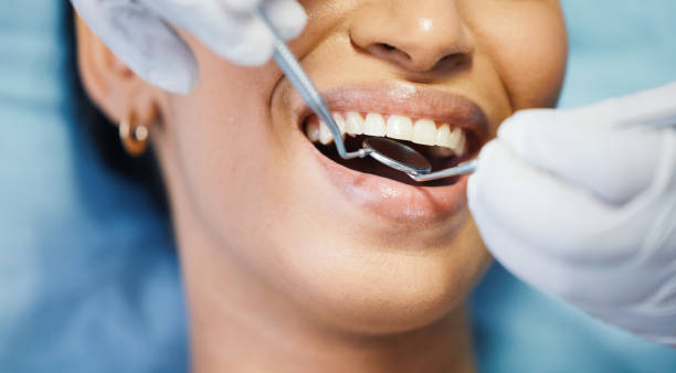Best Emergency Tooth Extraction in Trenton, MI